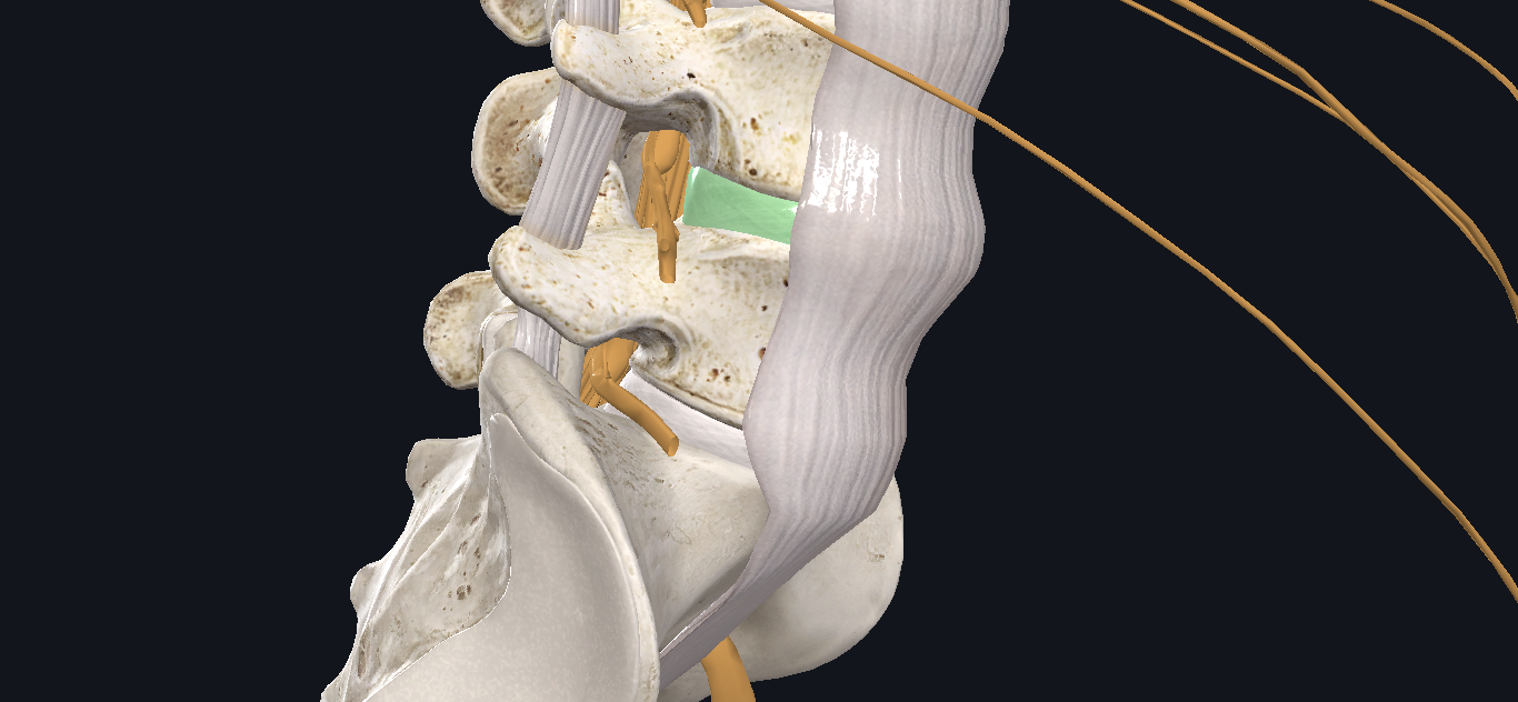 How To Heal A Bulging Disc